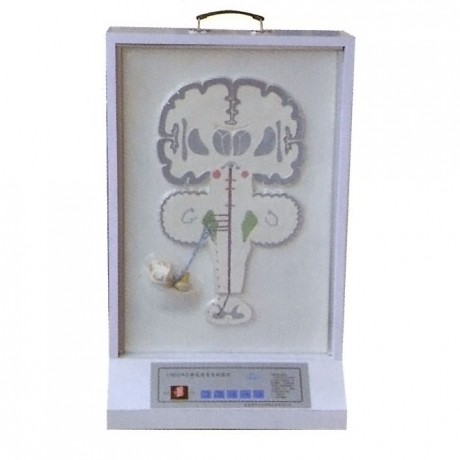 平衡覺傳導(dǎo)電動模型