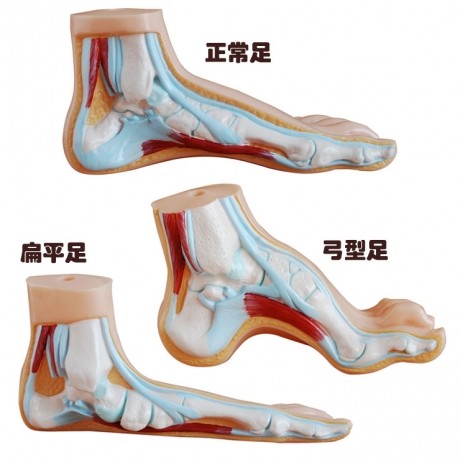 足弓模型